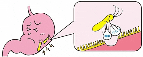 牛乳 逆効果 胃痛 急な胃痛を和らげる効果的な対処法と胃痛にならない為の予防法