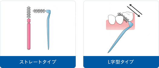 ストレートタイプ L字型タイプ