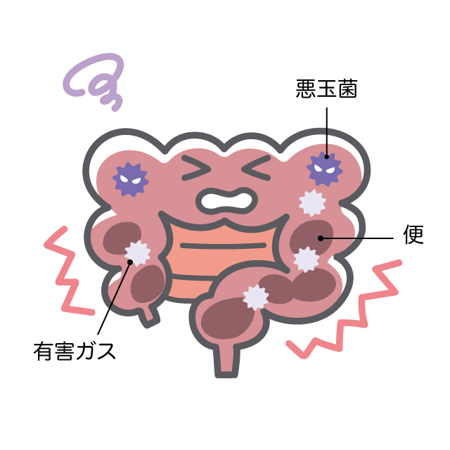 お腹の張り 腹部膨満感 の原因は何 痛みやガスを解消する方法を解説 Wakanote