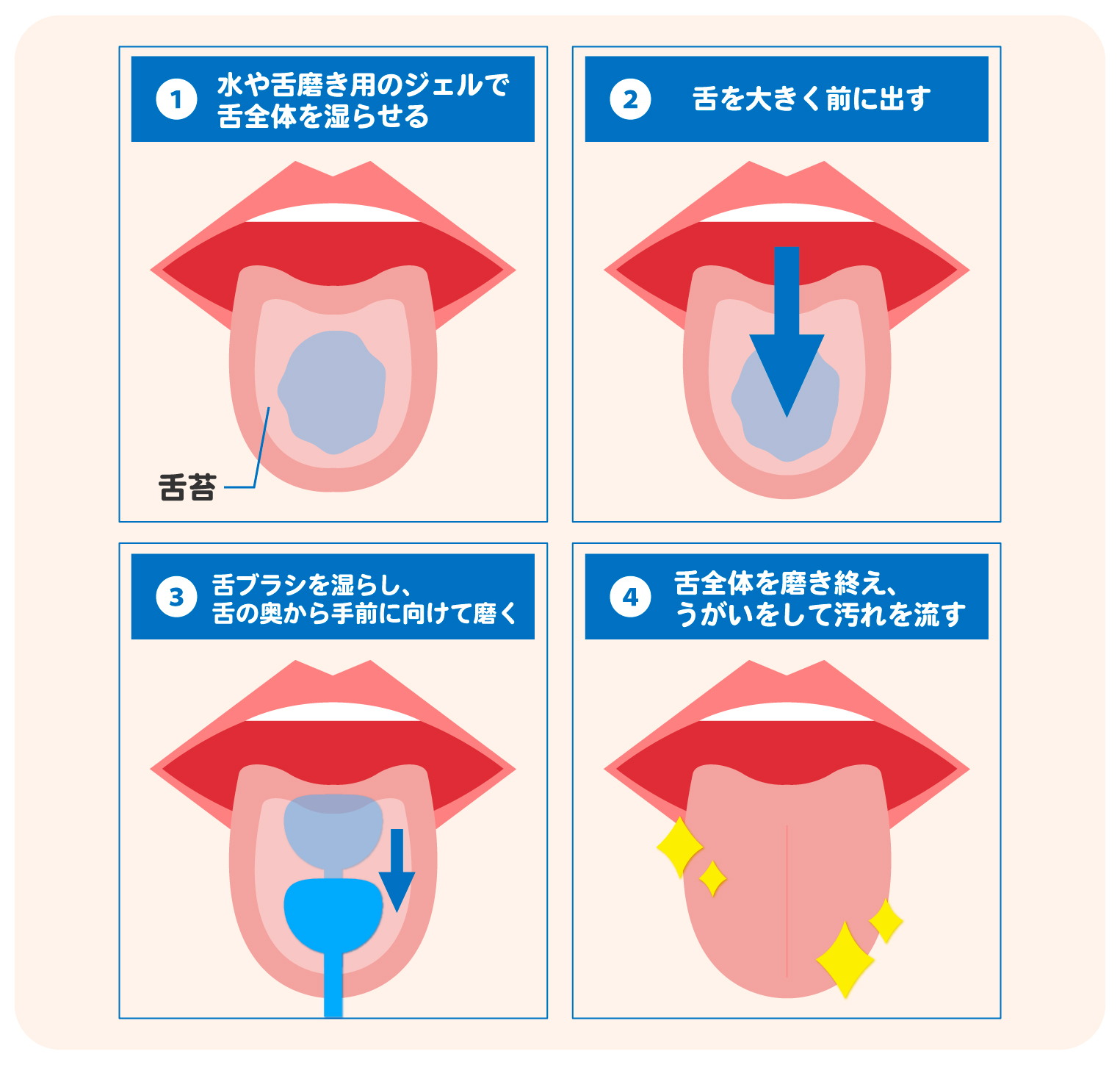 舌奥 臭い, 舌磨き は今 すぐ やめて – KBOUG