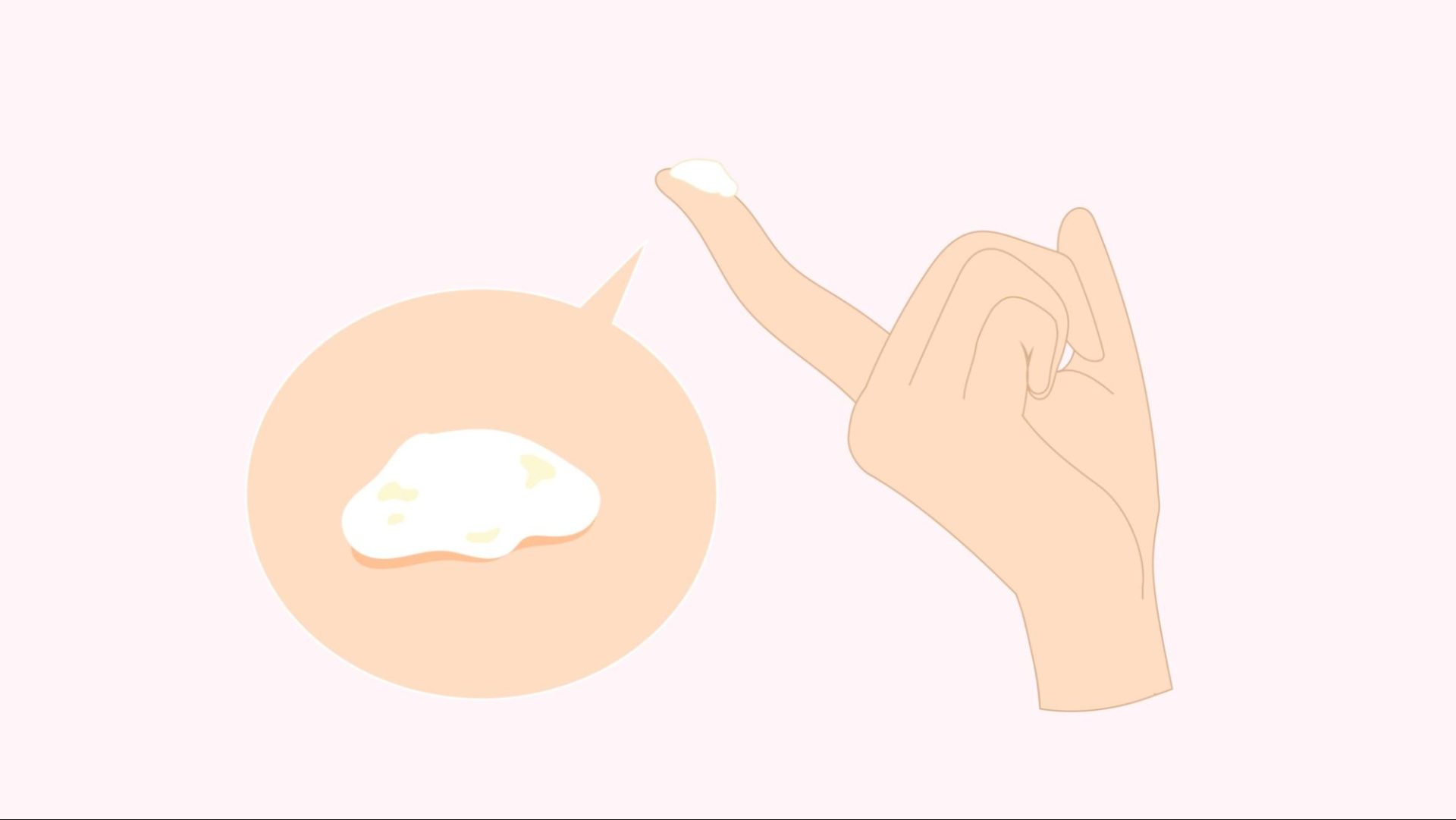 【おりものに白い塊】ねばねば・かゆくない・妊娠・病気のケースを解説！｜wakanote