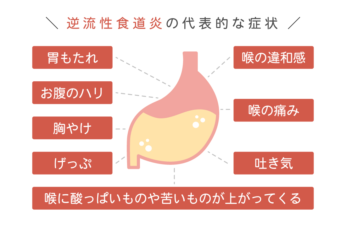 げっぷ 胃酸 の 味