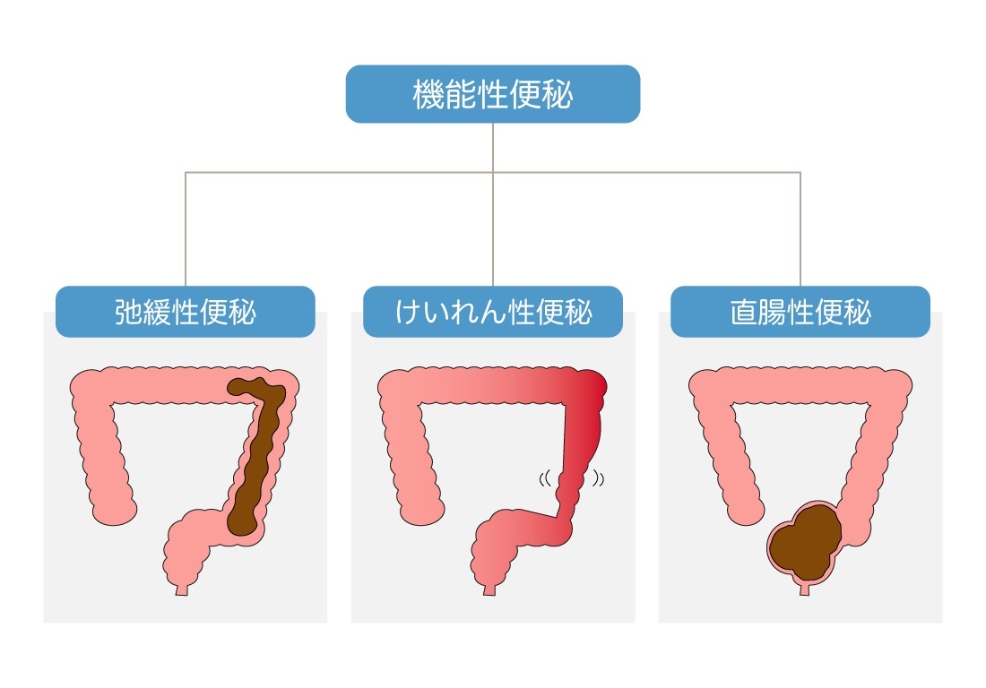 いつ医師に連絡すべきでしょうか?