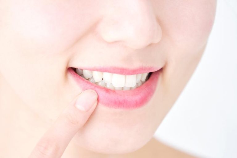 歯茎（歯ぐき）からの出血は『歯周病』が原因？！血が出た時の対処法を解説｜wakanote